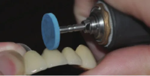 Dantų Lab Gumos Deimantų Šlifavimo Patarimai Poliravimo Porceliano Vainikėliai nereikia Reglaze ar Resintering