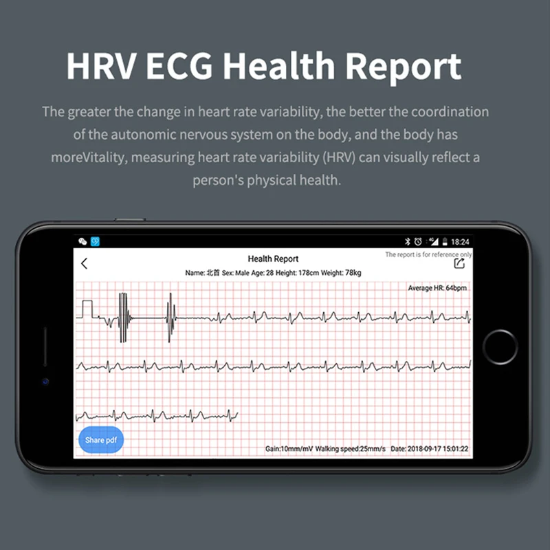 Greentiger G36 Smart Apyrankę EKG PPG Vandeniui Širdies ritmas, Kraujo Spaudimas Smart Apyrankė Fitness Tracker Skambučių Priminimas VS G26