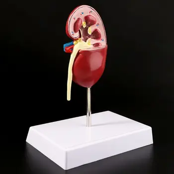 Inkstų Ligonių Modelis Anatomijos Anatomija Ligonių Patologinių Akmens Organų Mokymo Reikmenys L29K