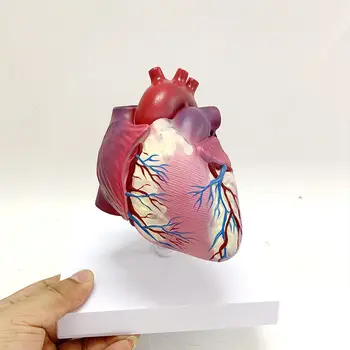 Žmogaus Aterosklerozė, Trombozė, Širdies Ligos Modelis Anatomija Širdies Struktūrą, Vidaus Vidaus Organų Patologija, Širdies Vožtuvų